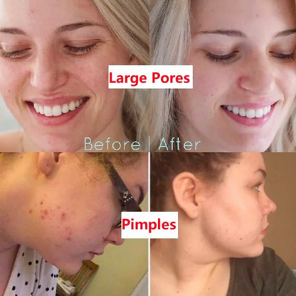 LOVILDS™ Green Tea Deep Cleanse Mask Stick